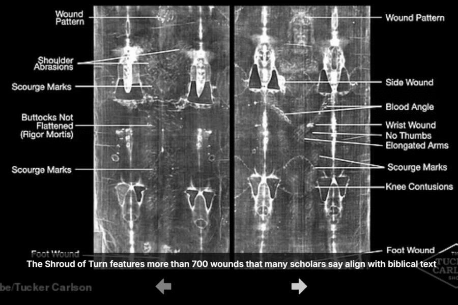 x-ray of shroud of turin